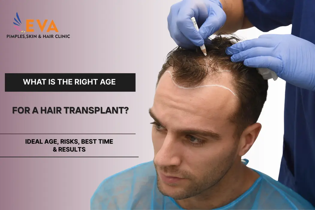 Right Age for a Hair Transplant