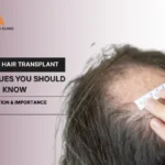 Hair Transplant Techniques