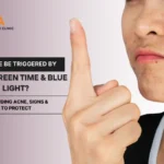 Can Acne Be Triggered by Long Screen Time & Blue Light