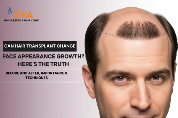 Hair Transplant Change Face Appearance Growth
