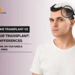 Medical Hair Transplant