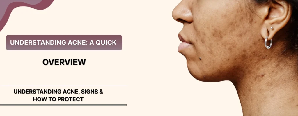 Acne Be Triggered by Long Screen Time & Blue Light