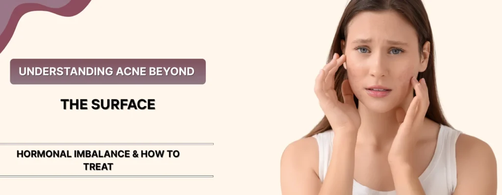 Acne Be a Sign of Gut