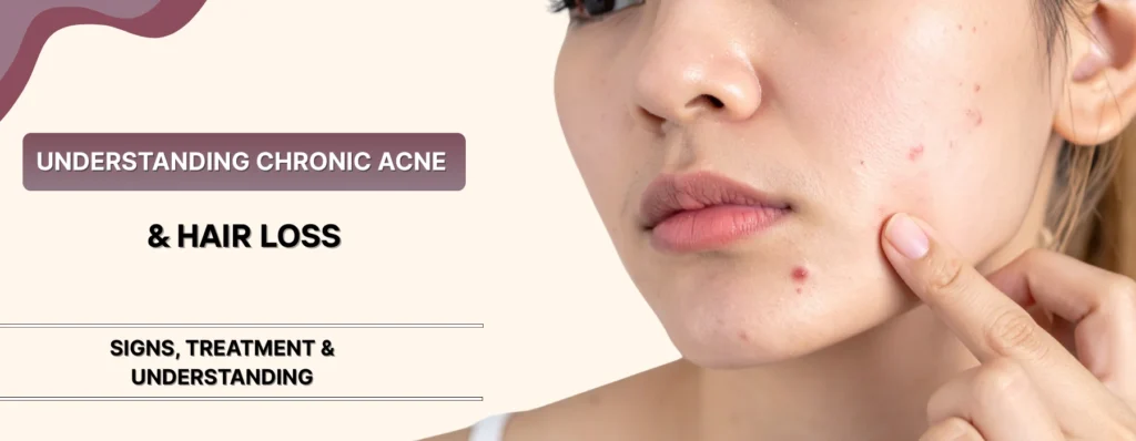 Chronic Acne & Hair Loss