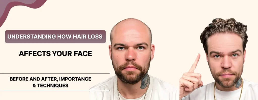 Hair Transplant Change Face Appearance Growth