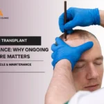 Hair Transplant Maintenance