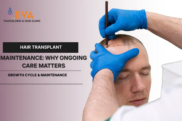 Hair Transplant Maintenance