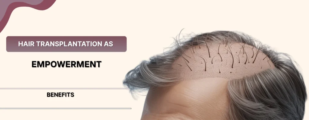Hair Transplantation in Overweight Patients
