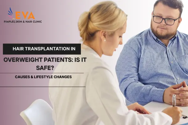 Hair Transplantation in Overweight Patients