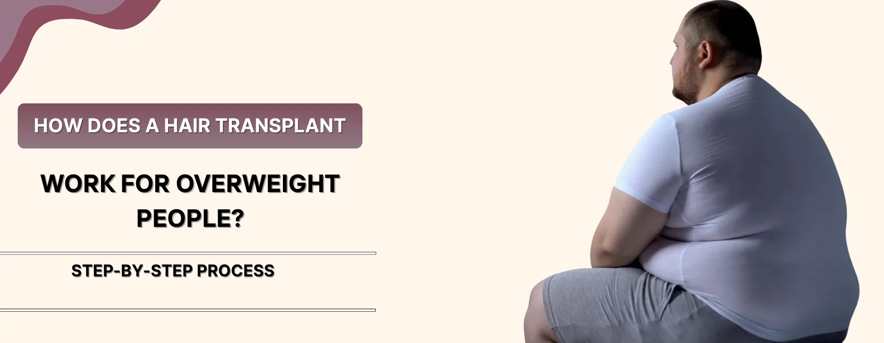 Hair Transplantation in Overweight Patients