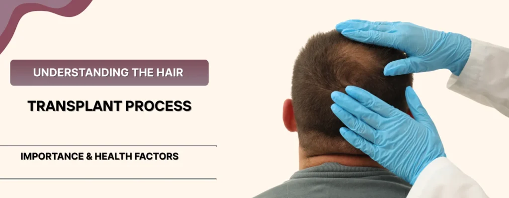 Transplanted Hair Fall Again