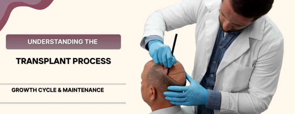 Hair Transplant Maintenance