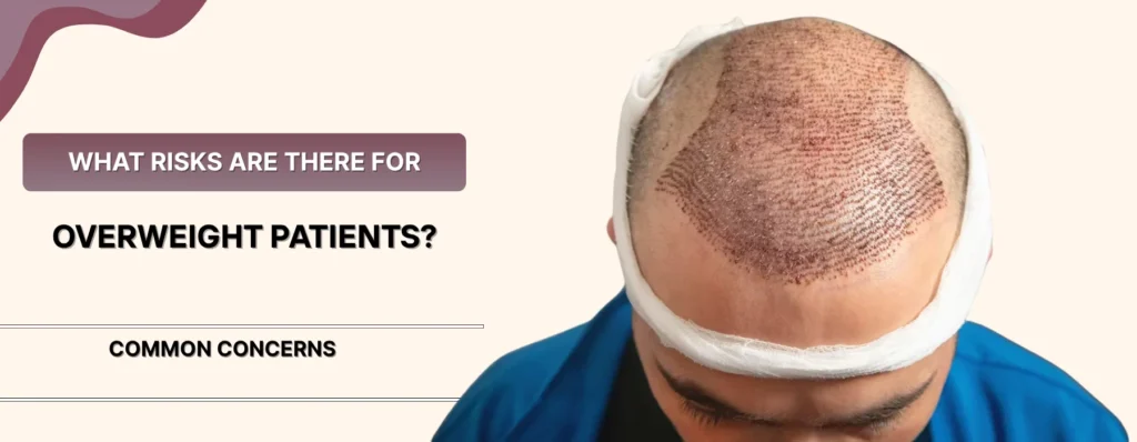 Hair Transplantation in Overweight Patients