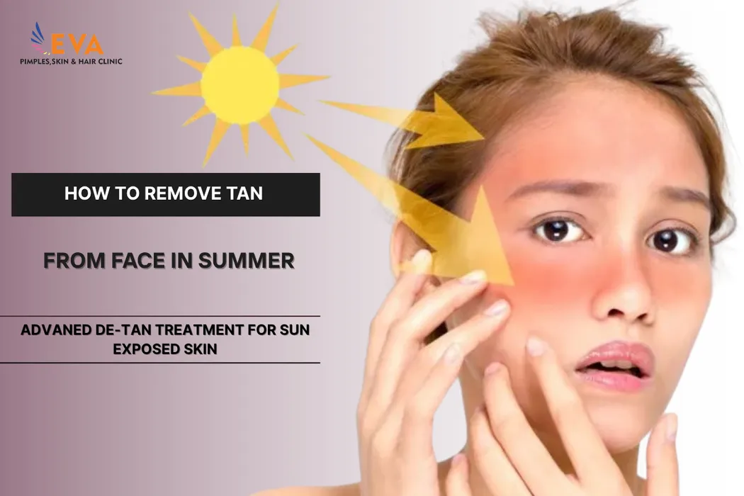 De-tan treatment for tanning skin