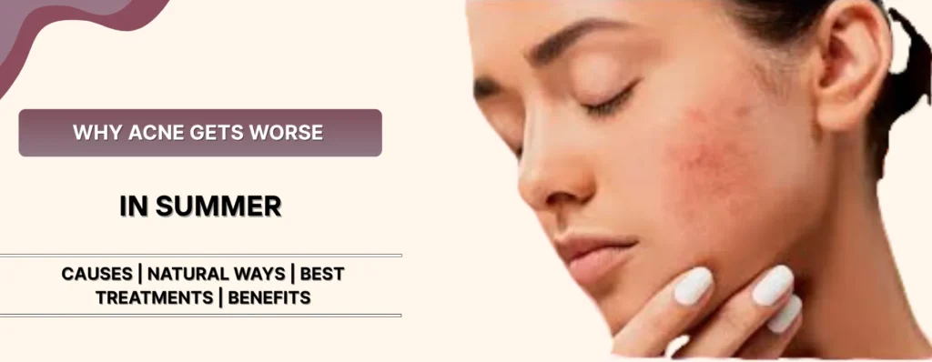 Why Acne Gets Worse in Summer