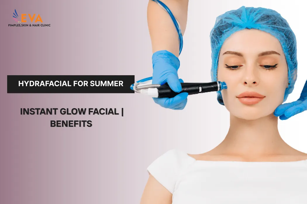 HydraFacial for Summer in Pune