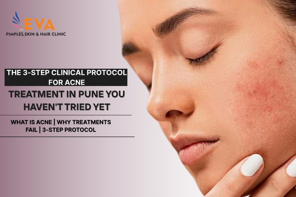 The 3-Step Clinical Protocol for Acne Treatment in Pune You Haven't Tried Yet