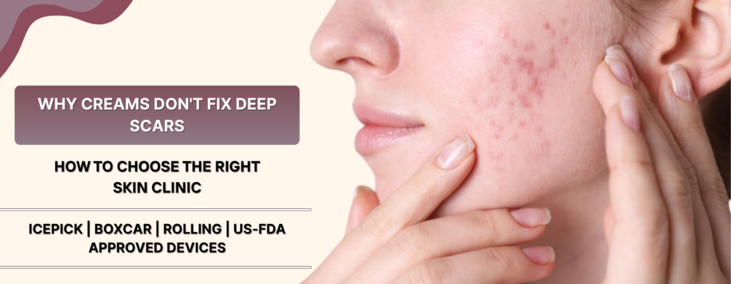 Clinical setting — dermatologist examining skin or laser device close-up — reinforces the