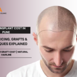 Hair Transplant Cost in Pune at Eva Pimple Skin and Hair Clinic