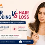 Hair Shedding vs Hair Loss treatment in Pune