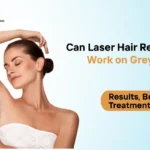 Laser Hair Removal Work on Blonde or Grey Hair