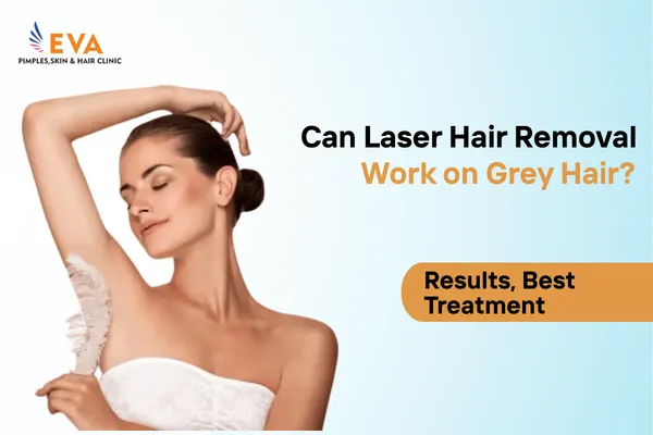 Laser Hair Removal Work on Blonde or Grey Hair