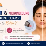 Laser vs Microneedling