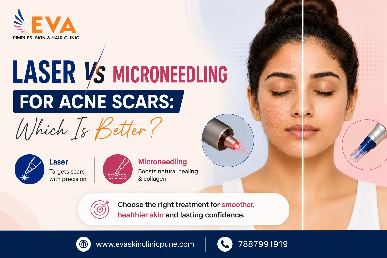 Laser vs Microneedling