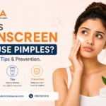 Sunscreen vs Acne