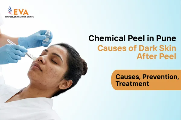 dark skin after chemical peel