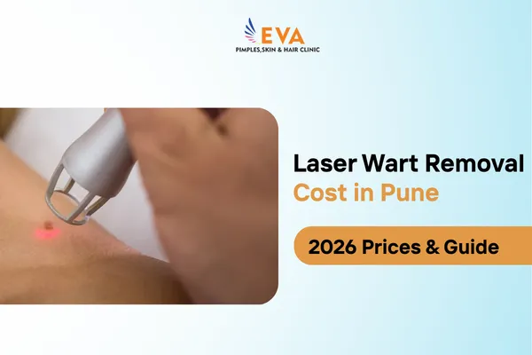laser wart removal cost