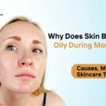 monsoon skincare for oily skin