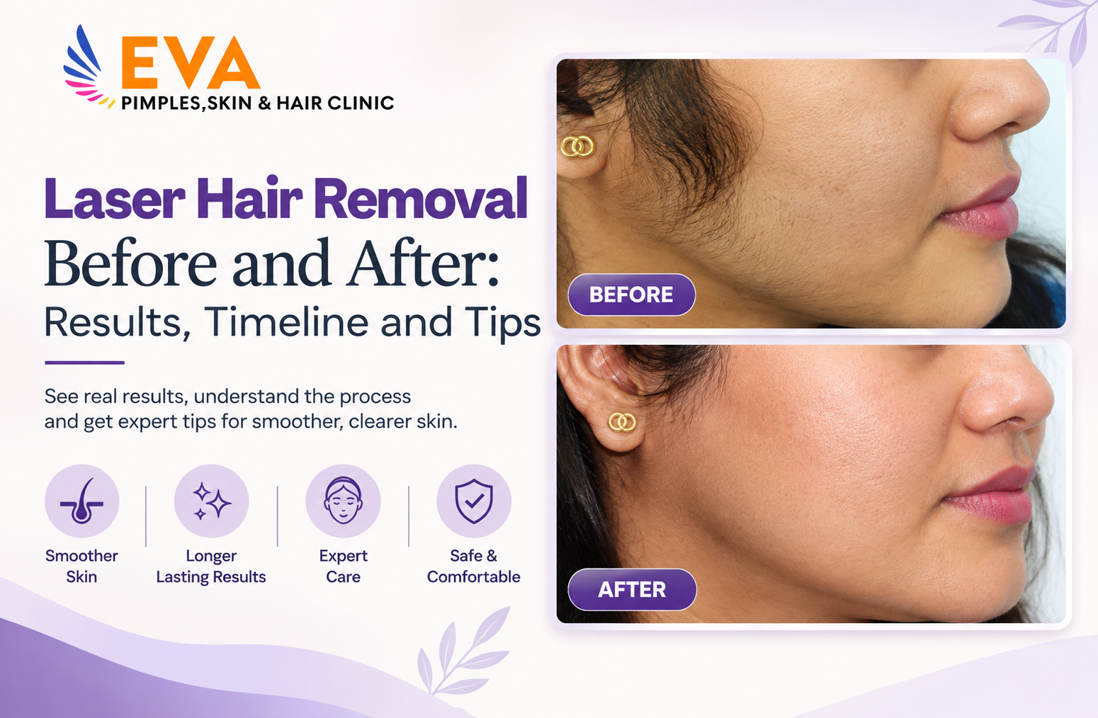 Laser Hair Removal Before and After