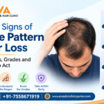 Male Pattern Hair Loss