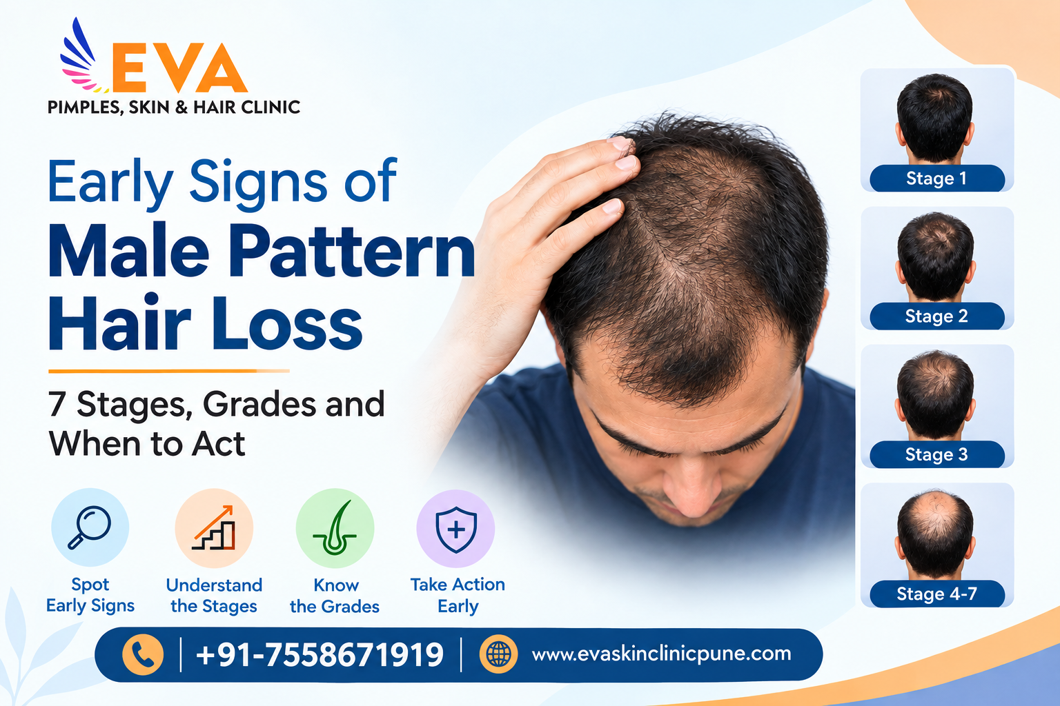 Male Pattern Hair Loss