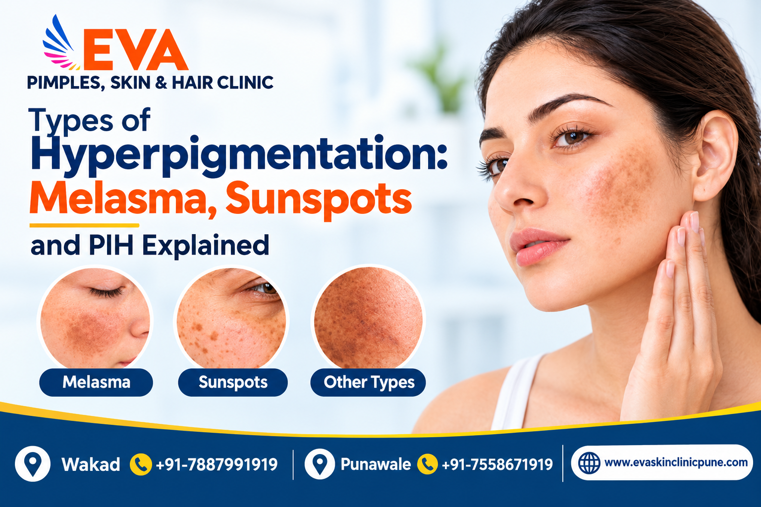 Skin Darkening and Hyperpigmentation Melasma, Sunspots, and PIH Explained