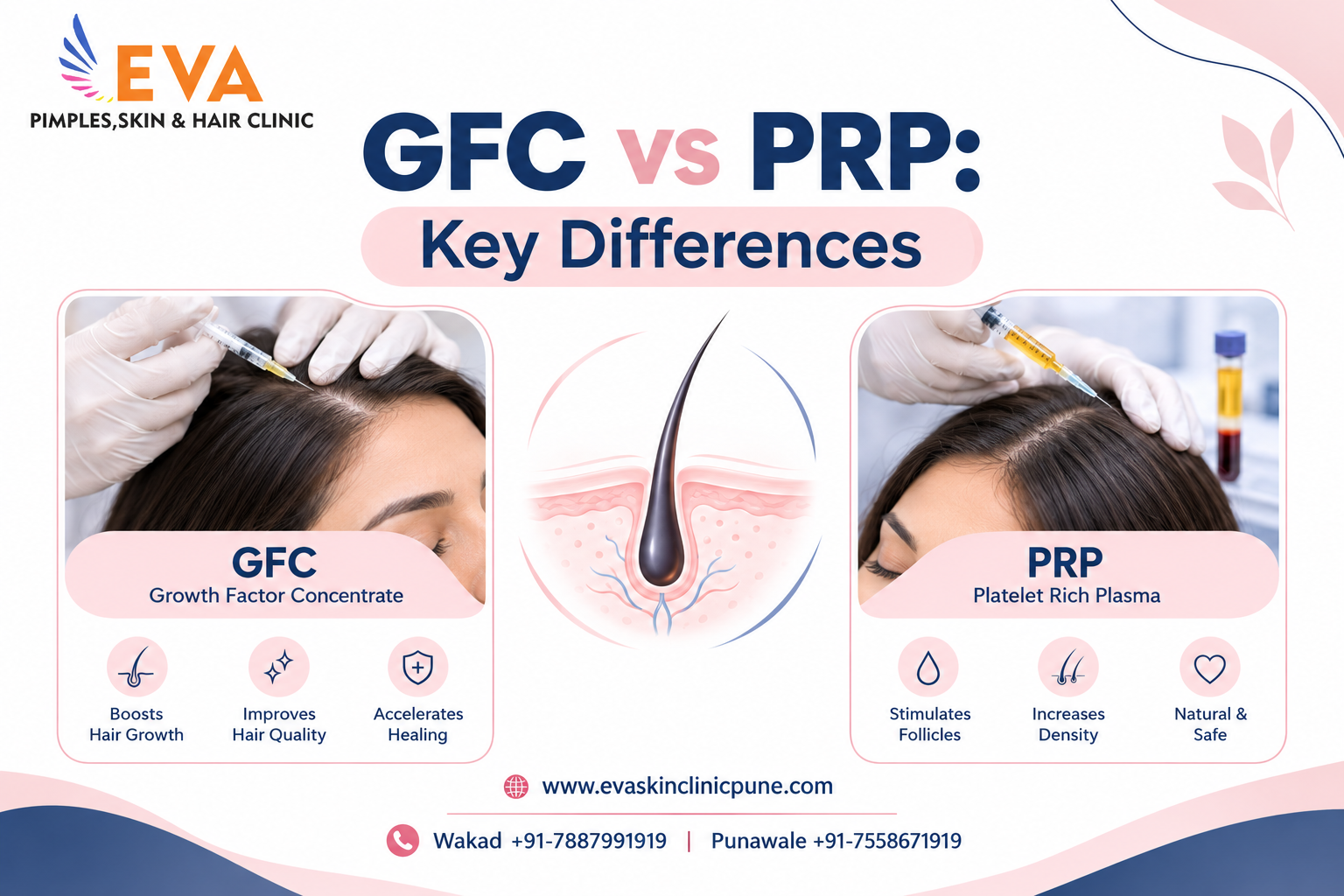 PRP Hair Treatment