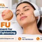 HIFU Treatment for Skin Tightening and a Non-Surgical Facial Lift
