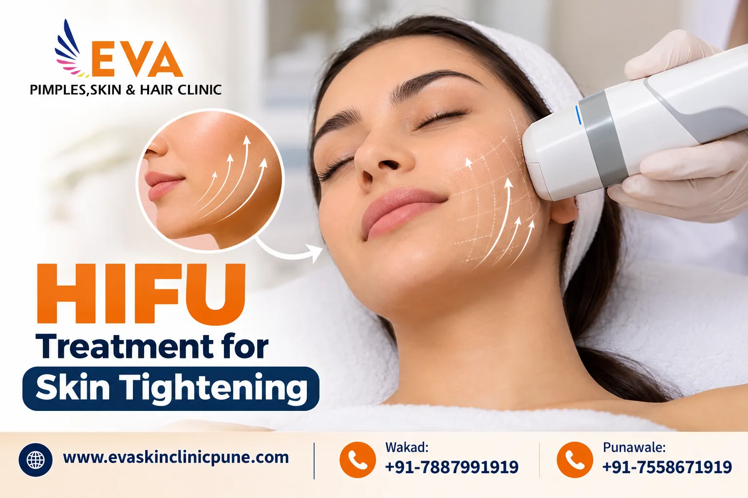 HIFU Treatment for Skin Tightening and a Non-Surgical Facial Lift