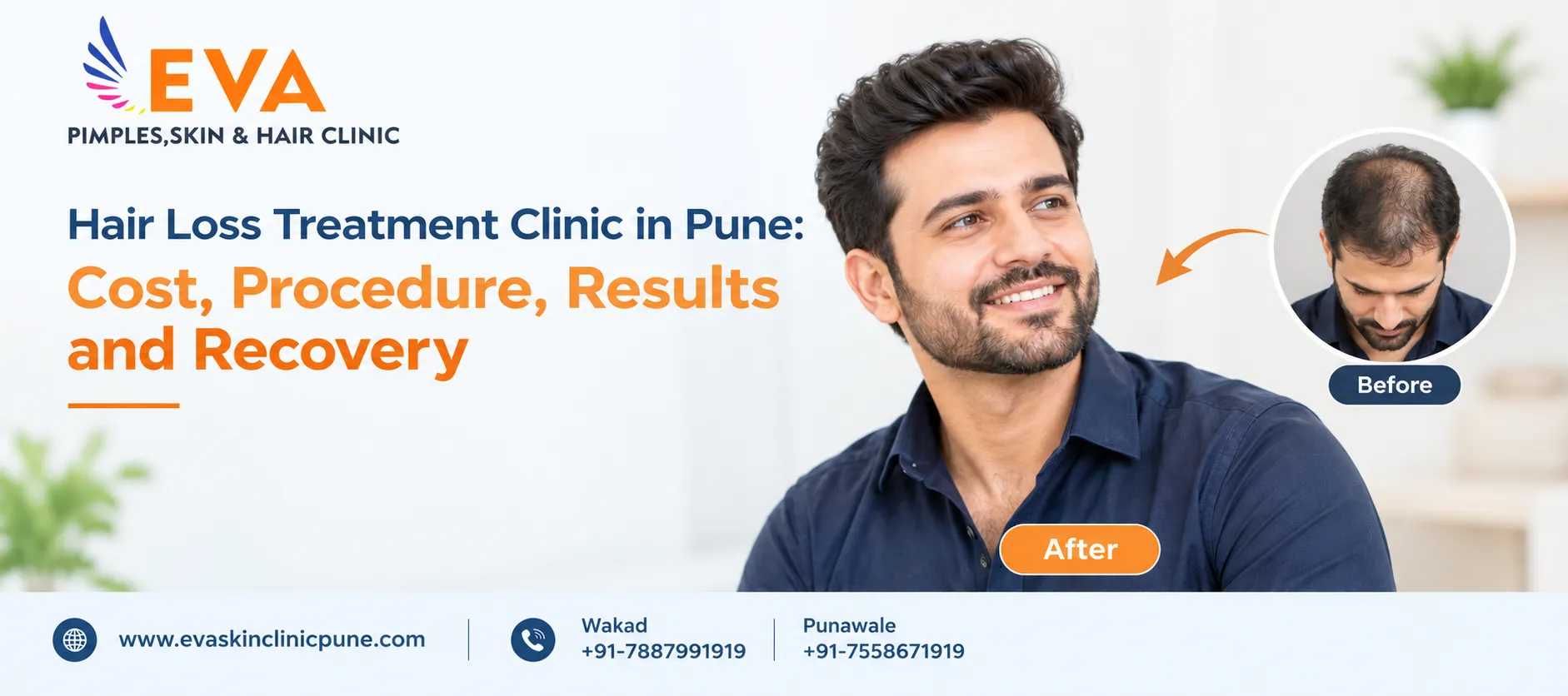 Hair Loss Treatment Clinic in Pune for Hair Regrowth